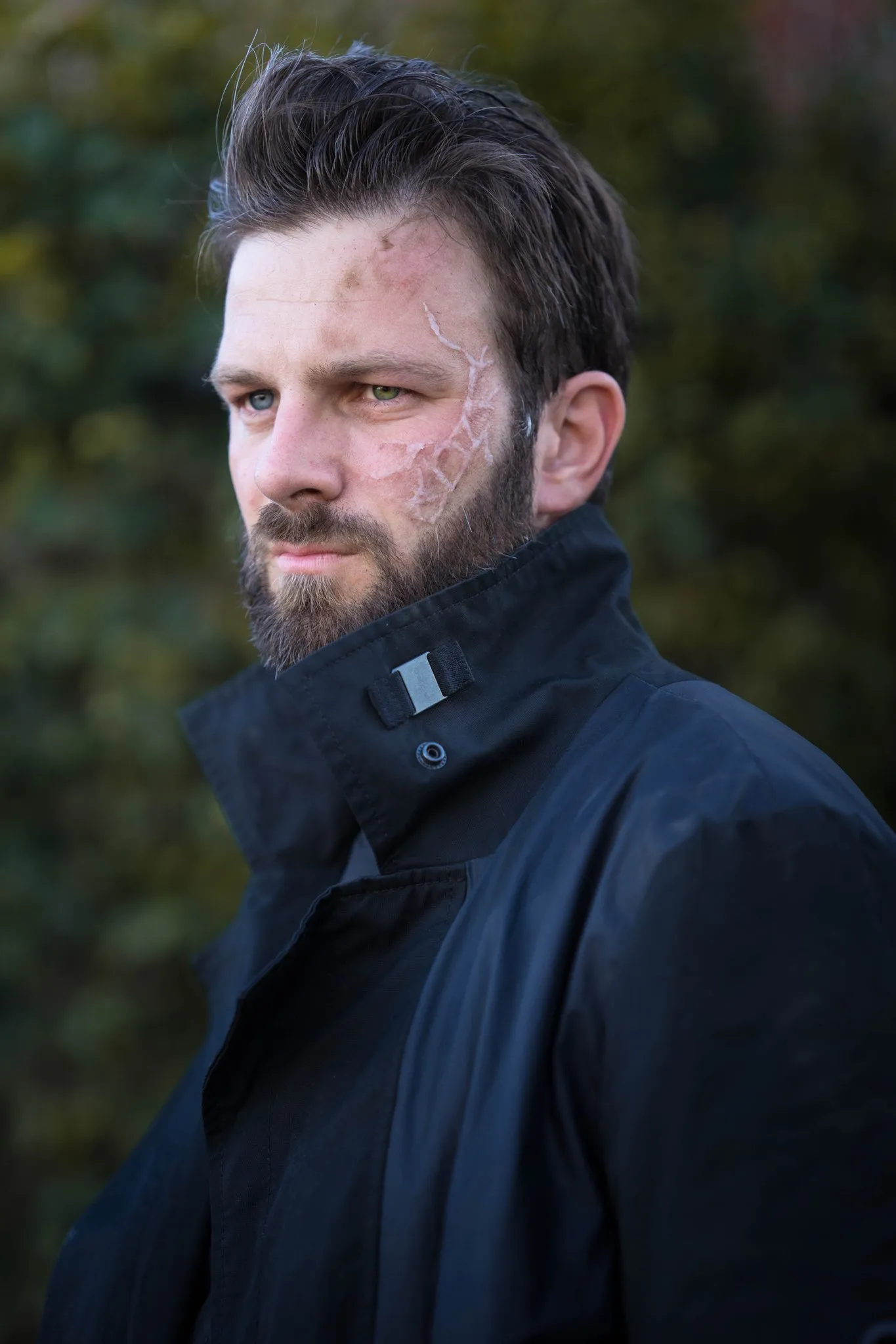 SFX Blessure Guerre
