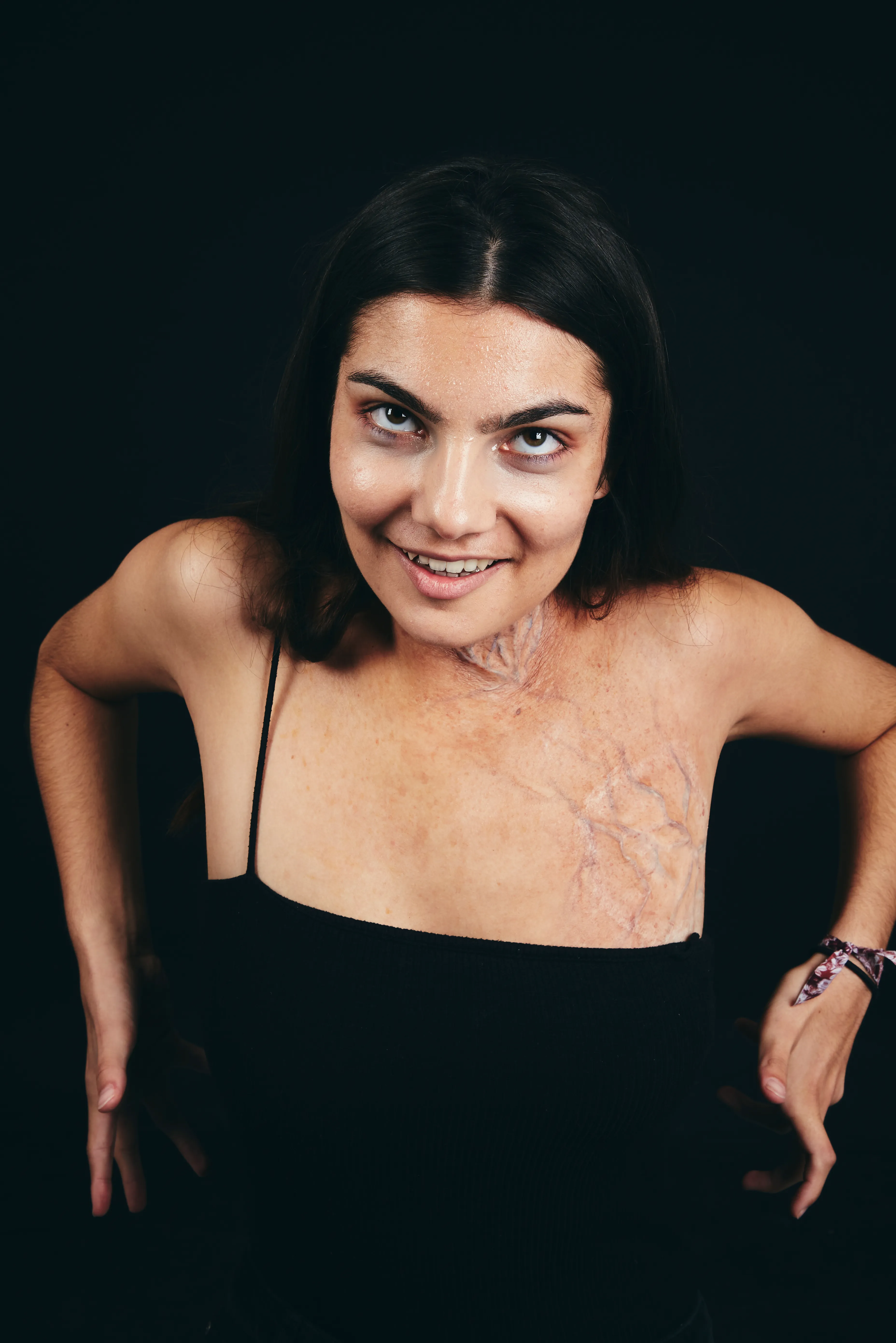 SFX Brûlure Portrait